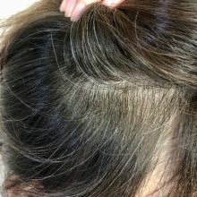白髪を増やしたくないなら染めないこと！　老化させないこと！　・・・・。